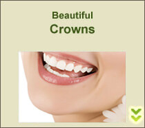 Close-up portrait picture of the mouth of a smiling woman with perfect teeth happy with the beautiful crowns she had with the Dental Center of Costa Rica, San Jose, Costa Rica.