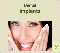 Portrait picture of a smiling woman with long brown hair and beautiful teeth, happy with dental implants she had with the Dental Center of Costa Rica, San Jose, Costa Rica.